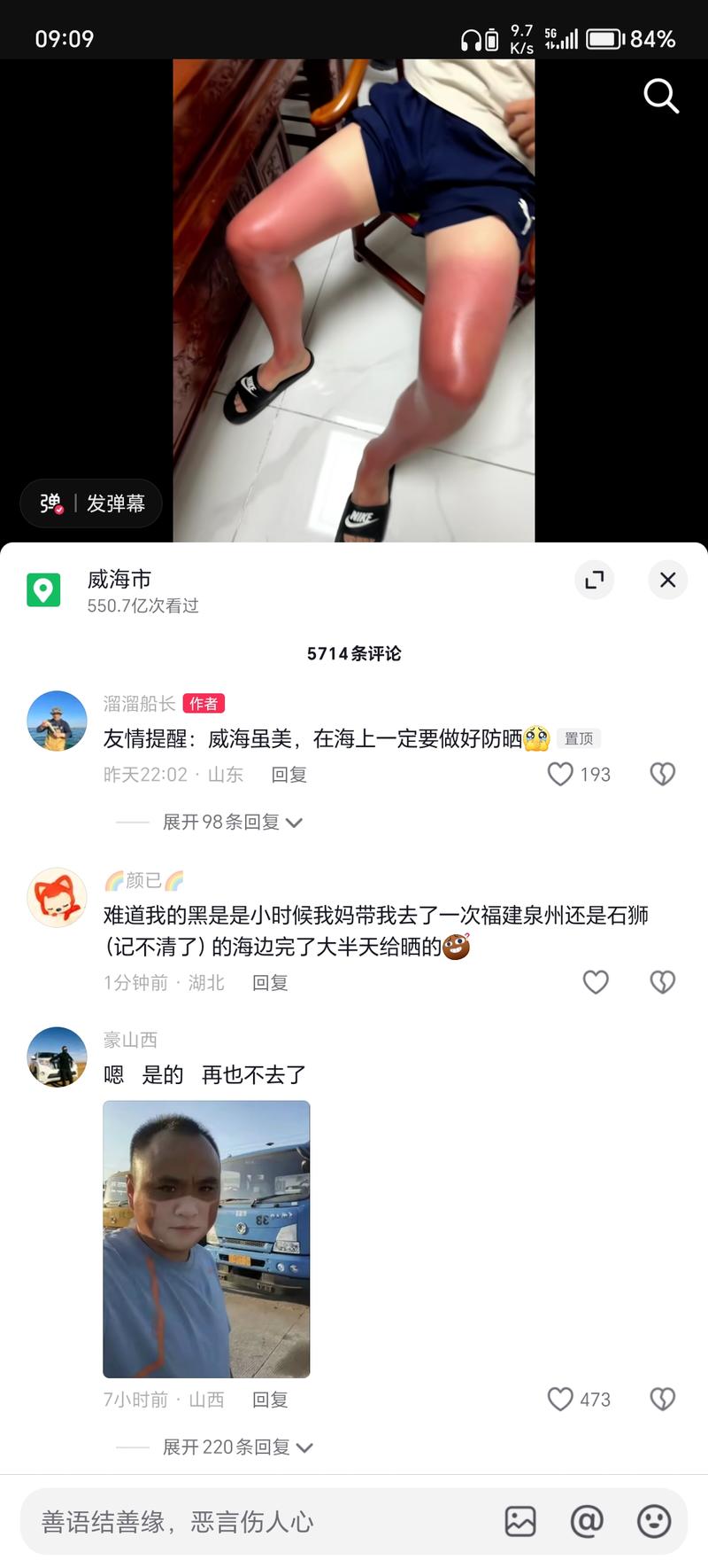马上三伏天了 紫外线最…#情报-搞钱线报📢论坛-网创交流-优创圈